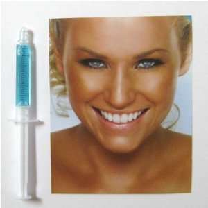  After Tooth Whitening Remineralization Treatment Health 