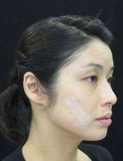 Magic Japan Slim Slimer Face facial Stickers slimming  